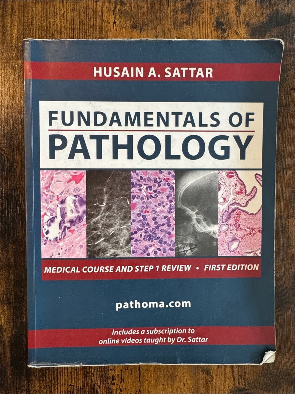 Fundamentals of Pathology by Husain A. Sattar - Blue/Red Textbook